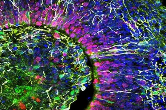 Hình ảnh lát cắt cơ quan tế bào não người (ảnh Đại học California San Diego)
