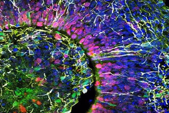 Hình ảnh lát cắt cơ quan tế bào não người (ảnh Đại học California San Diego)