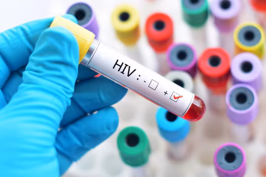Nghiên cứu mới làm dấy lên hy vọng về một liệu pháp loại bỏ hoàn toàn virus HIV khỏi cơ thể người (Ảnh: Getty)