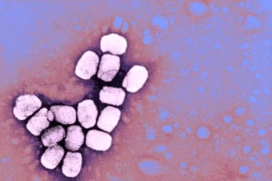 Bệnh đậu mùa từng khiến 500 triệu người chết trong thế kỷ 20 (Ảnh: Newsweek)