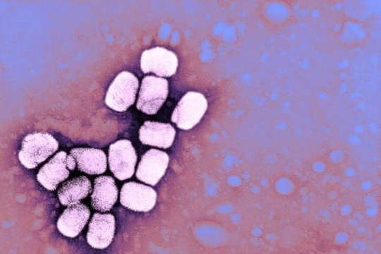 Bệnh đậu mùa từng khiến 500 triệu người chết trong thế kỷ 20 (Ảnh: Newsweek)