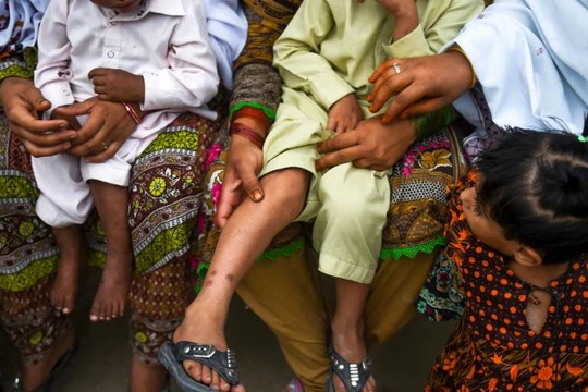 Những trẻ em bị nhiễm HIV ở ngôi làng Wasayo, thành phố Ratodero được mẹ cho đi khám (Ảnh: CNN)