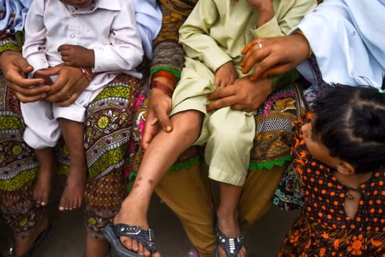 Những trẻ em bị nhiễm HIV ở ngôi làng Wasayo, thành phố Ratodero được mẹ cho đi khám (Ảnh: CNN)