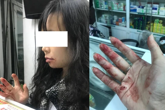 Chị N.D phản ánh bị tài xế Uber hành hung (ảnh nhân vật cung cấp)