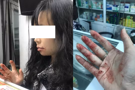 Chị N.D phản ánh bị tài xế Uber hành hung (ảnh nhân vật cung cấp)