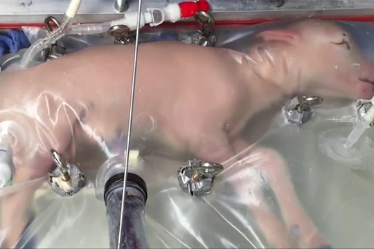 Nuôi dưỡng cừu non trong tử cung nhân tạo