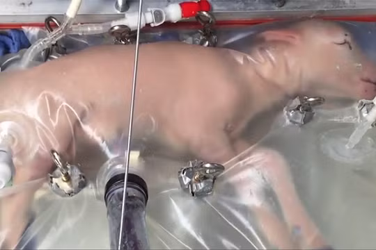 Nuôi dưỡng cừu non trong tử cung nhân tạo