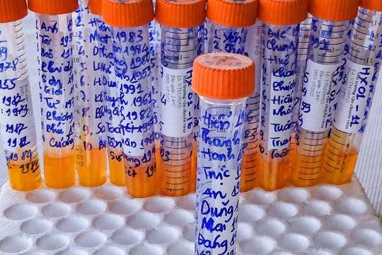 Mẫu xét nghiệm SARS-CoV-2 theo dạng gộp 10 được ngành y tế Đà Nẵng áp dụng thực hiện