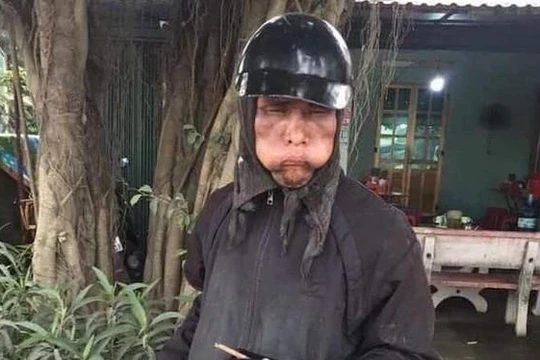 Đối tượng xin ăn mặc đồ đen, mặt biến dạng bị người dân chụp ảnh (ảnh Chi Lê)