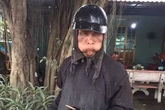 Đối tượng xin ăn mặc đồ đen, mặt biến dạng bị người dân chụp ảnh (ảnh Chi Lê)