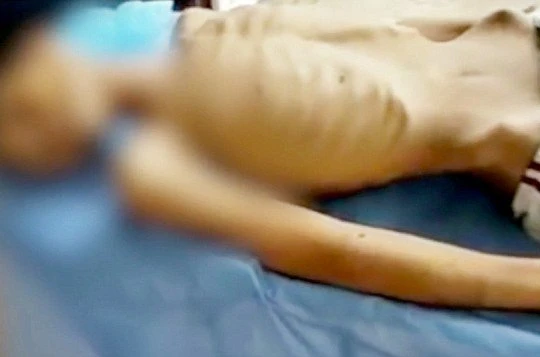 Một tù nhân được cho là đã chết vì đói và bệnh tật tại nhà tù ở miền trung Venezuela - Ảnh cắt từ video clip.