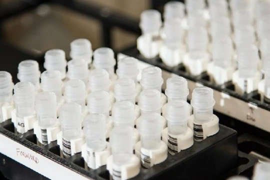 Phương pháp xét nghiệm virus corona mới qua nước bọt được coi là bước đột phá quan trọng trong cuộc chiến chống đại dịch COVID-19 (Ảnh: 6do.new).