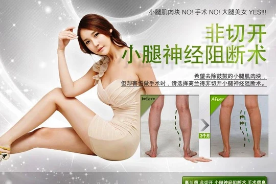 Quảng cáo phẫu thuật nội soi phong tỏa bắp chân trên mạng ở Trung Quốc (Ảnh: Sohu).