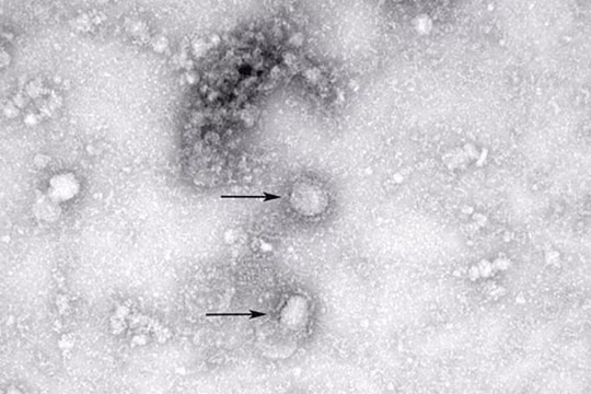 Hình ảnh virus corona chủng mới dưới ống kính hiển vi (Ảnh: Đông Phương)