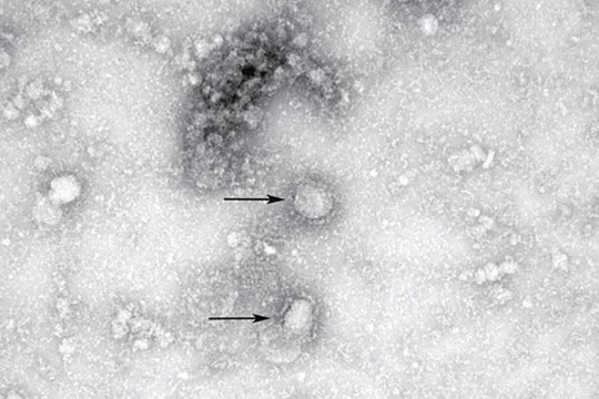Hình ảnh virus corona chủng mới dưới ống kính hiển vi (Ảnh: Đông Phương)