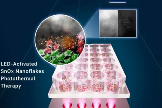 Liệu pháp này nung nóng làm chết tế bào ung thư trong khi tế bào khỏe mạnh được bảo vệ. Ảnh: ACSNano. 