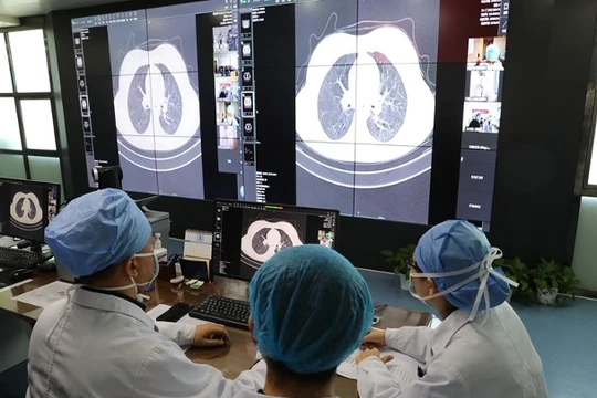 Các bác sĩ tại bệnh viện Vũ Hán đang hội chẩn về tình trạng bệnh nhân (Ảnh: Đông Phương)