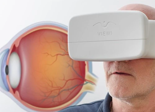 Smartphone sẽ sớm có thể phát hiện tăng nhãn áp