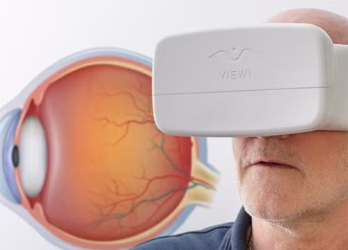 Smartphone sẽ sớm có thể phát hiện tăng nhãn áp