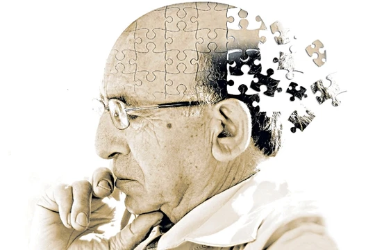 Dùng đèn LED điều trị bệnh Alzheimer