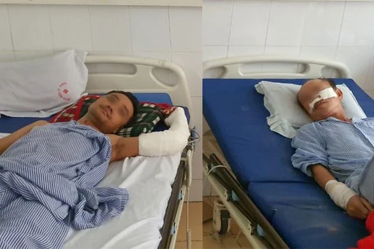 2 bệnh nhân đang điều trị tại Bệnh viện 198.