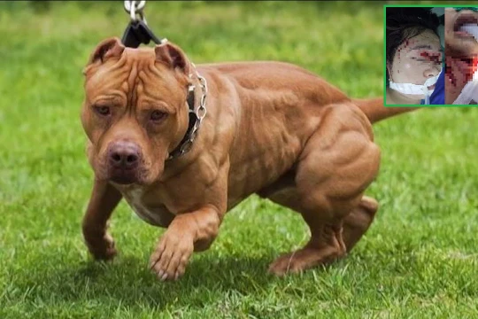 Một con chó Pitbull tấn công em bé 4 tuổi và mẹ, khiến các nạn nhân bị thương nặng, cấp cứu tới Bệnh viện Đa khoa Trung ương Thái Nguyên (Ảnh: BVCC + Internet)