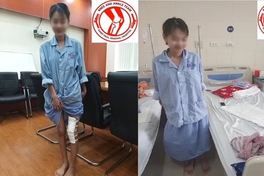 Nữ sinh U. đứng, tập đi lại sau khi được phẫu thuật.