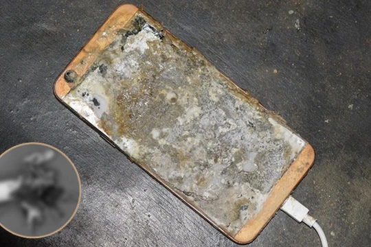 Chiếc điện thoại phát nổ khi đang sạc khiến thiếu niên bị mất vĩnh viễn bàn tay trái.