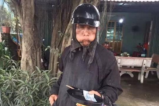 Một người ăn xin mặc đồ đen, mặt biến dạng bị người dân chụp ảnh.