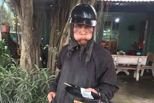 Một người ăn xin mặc đồ đen, mặt biến dạng bị người dân chụp ảnh.