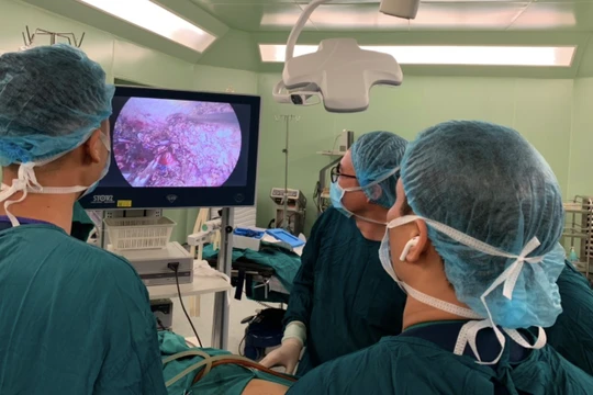 Các bác sĩ thực hiện kỹ thuật phẫu thuật cắt gan nội soi