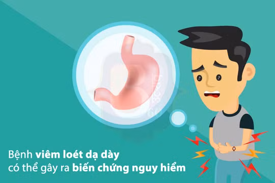 Bệnh viêm loét dạ dày có thể gây nhiều biến chứng nguy hiểm, ví dụ chảy máu dạ dày, ung thư dạ dày ở trẻ nhỏ.