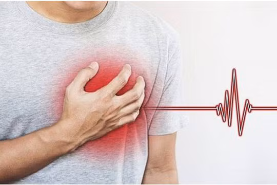 Bệnh nhồi máu cơ tim và đột quỵ thường bị nhầm lẫn, khiến cho việc điều trị, sơ cứu gặp khó khăn.