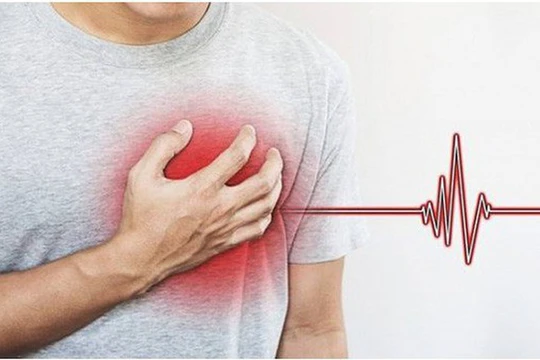 Bệnh nhồi máu cơ tim và đột quỵ thường bị nhầm lẫn, khiến cho việc điều trị, sơ cứu gặp khó khăn.