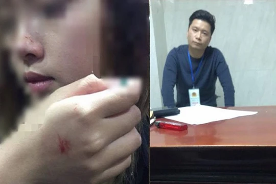 Đối tượng sàm sỡ nữ sinh trong thang máy chỉ bị phạt 200 nghìn đồng.