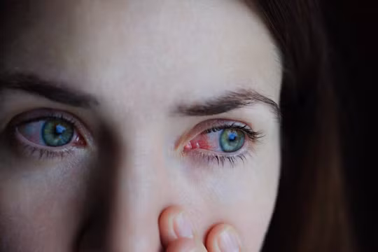 Ảnh minh họa (theo Business Insider)