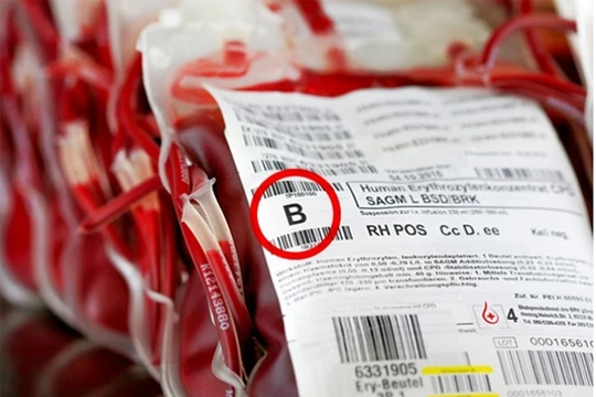 Ảnh minh họa (theo Brightside)