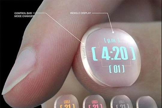 Ảnh minh họa (theo Brightside)