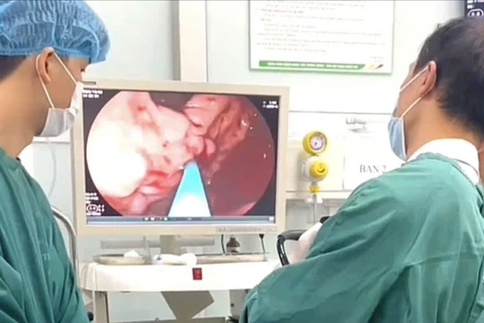 Người đàn ông bị xuất huyết tiêu hóa nguy kịch, bác sĩ chỉ ra nguyên nhân phổ biến