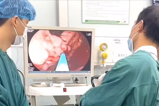 Người đàn ông bị xuất huyết tiêu hóa nguy kịch, bác sĩ chỉ ra nguyên nhân phổ biến