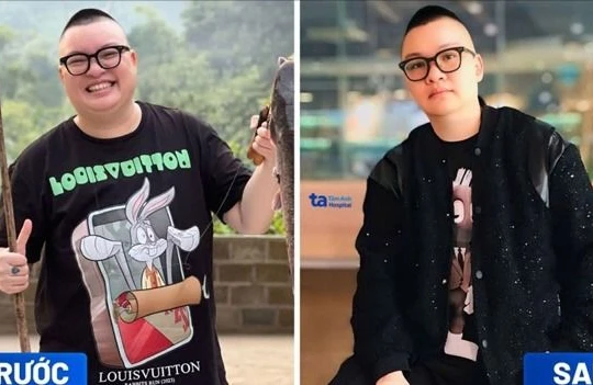 Giảm cân chuẩn y khoa mang đến giải pháp bền vững cho thị trường làm đẹp