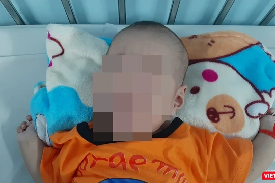 Bé trai 3 tháng tuổi bị tràn dịch phổi, nguy kịch tính mạng
