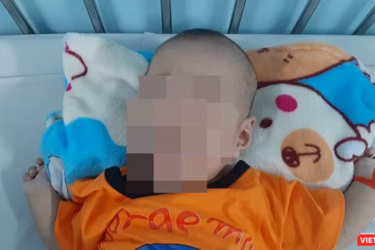 Bé trai 3 tháng tuổi bị tràn dịch phổi, nguy kịch tính mạng