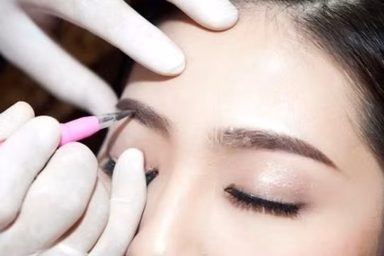 Một người phụ nữ bị hôn mê sau khi xăm chân mày.