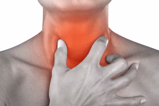 Sưng cổ, nuốt đau, tưởng bệnh cảm thông thường hóa ra là ổ áp xe khổng lồ. Ảnh minh họa: Internet