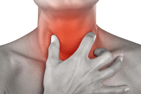 Sưng cổ, nuốt đau, tưởng bệnh cảm thông thường hóa ra là ổ áp xe khổng lồ. Ảnh minh họa: Internet