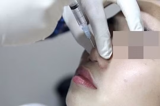 Biến chứng do thẩm mỹ tăng: Người hành nghề không có chuyên môn