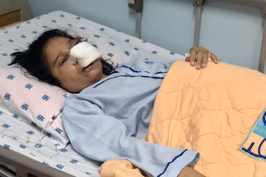 Thai phụ 29 tuần tuổi mắc bệnh hiếm gặp, nguy kịch đến tính mạng và thai nhi. Ảnh: BVCC