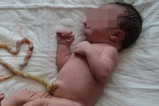 Một em bé bị tử vong nghi do mẹ sinh thuận tự nhiên. Ảnh minh họa