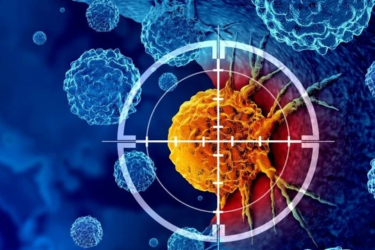 Sự bùng nổ của AI sẽ tạo ra đột phá cho chẩn đoán, điều trị ung thư